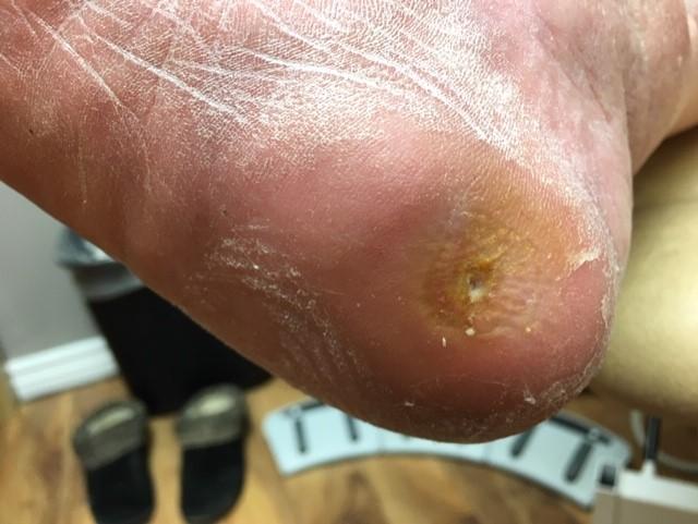 Medical Foot Care